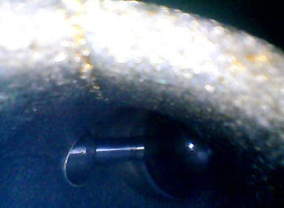 利用HIE系列內(nèi)窺鏡檢測到的某4s店發(fā)動機進(jìn)氣道圖片