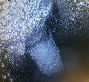 黑不溜秋的還有粉末狀，好惡心~  